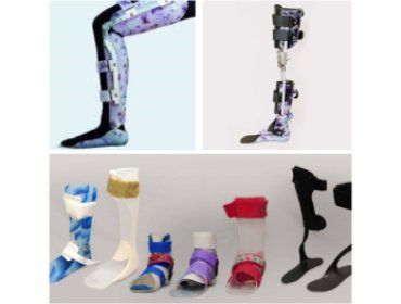 Pediatric Orthoses in Navsari