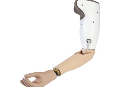 Custom Foot Orthoses in Navsari